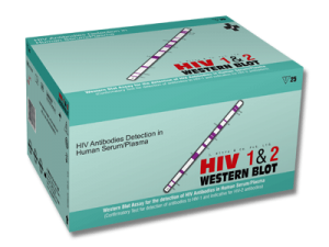 HIV-1-2-Western-Blot
