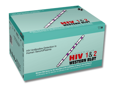 HIV-1-2-Western-Blot