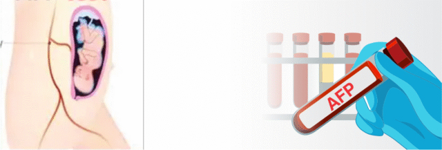 Blog Images AFP Your Early Warning System for Tumors