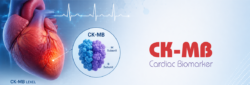 Blog Images CK MB An Important Cardiac Biomarker for the Diagnosis of Heart Muscle Damage