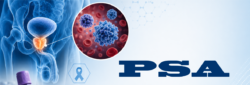 Blog Images Prostate Specific Antigen PSA Early Detection Lifesaving Insights