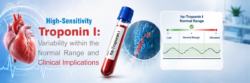 Blog Images Troponin I