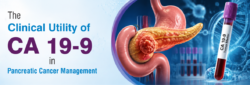 Blog Images The Clinical Utility of CA 19 9