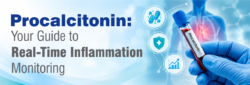 Blog Procalcitonin Your Guide to Real Time Inflammation Monitoring